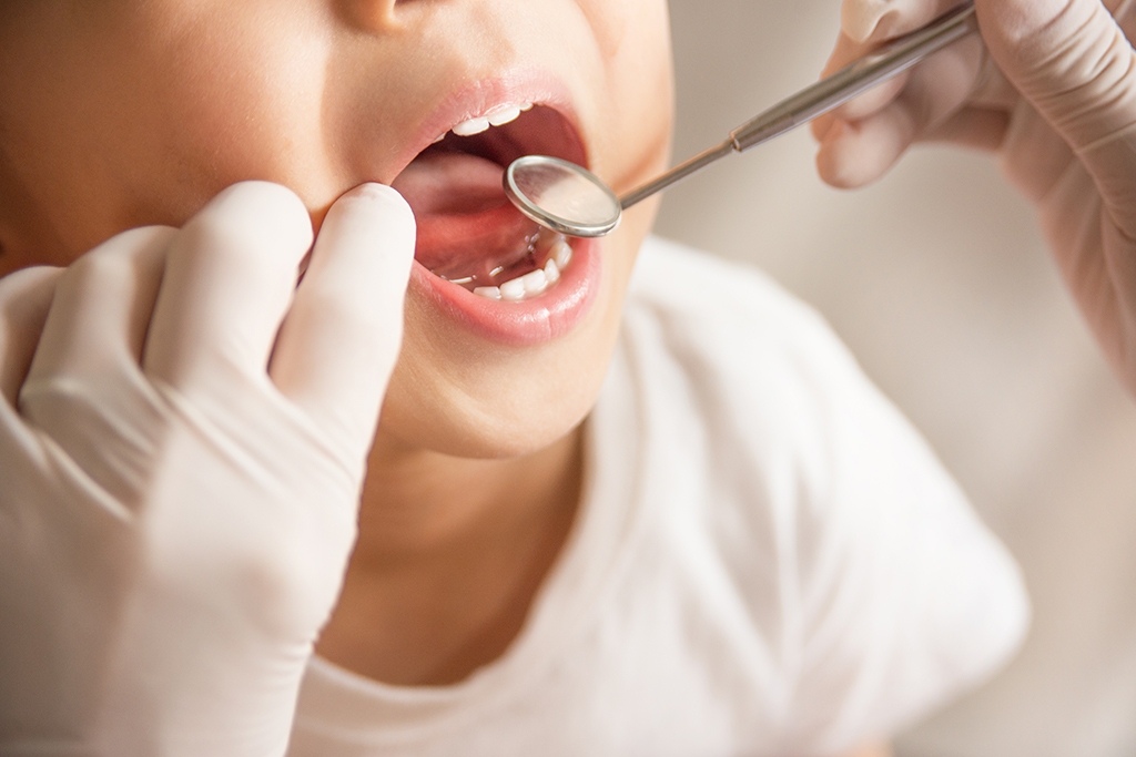 群馬県桐生市・あきこ歯科医院・お口の健康に影響する歯並びについてお伝えしています